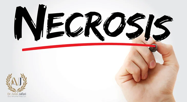 درمان نکروز