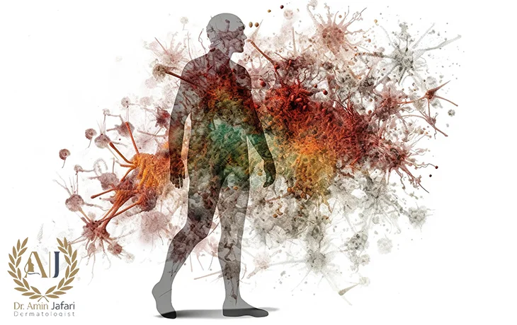 عفونت و سم علائم نکروز