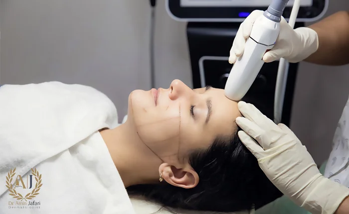 اندولیفت بهتر است یا هایفو