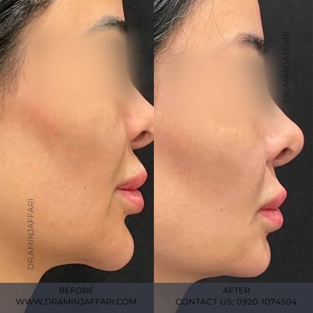 تخصص دکتر امین جعفری