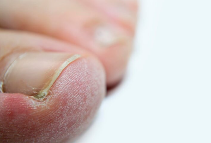 کلینیک درمان ناخن دکتر امین جعفری