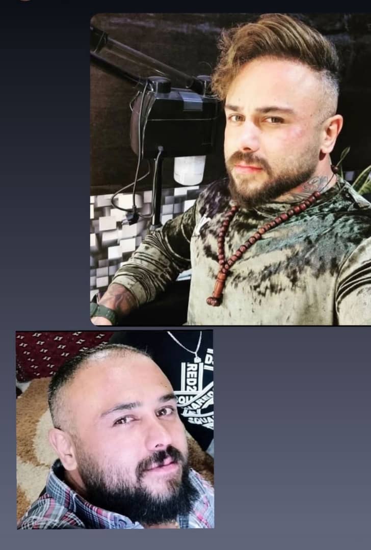 کاشت ابرو طبیعی دکتر جعفری