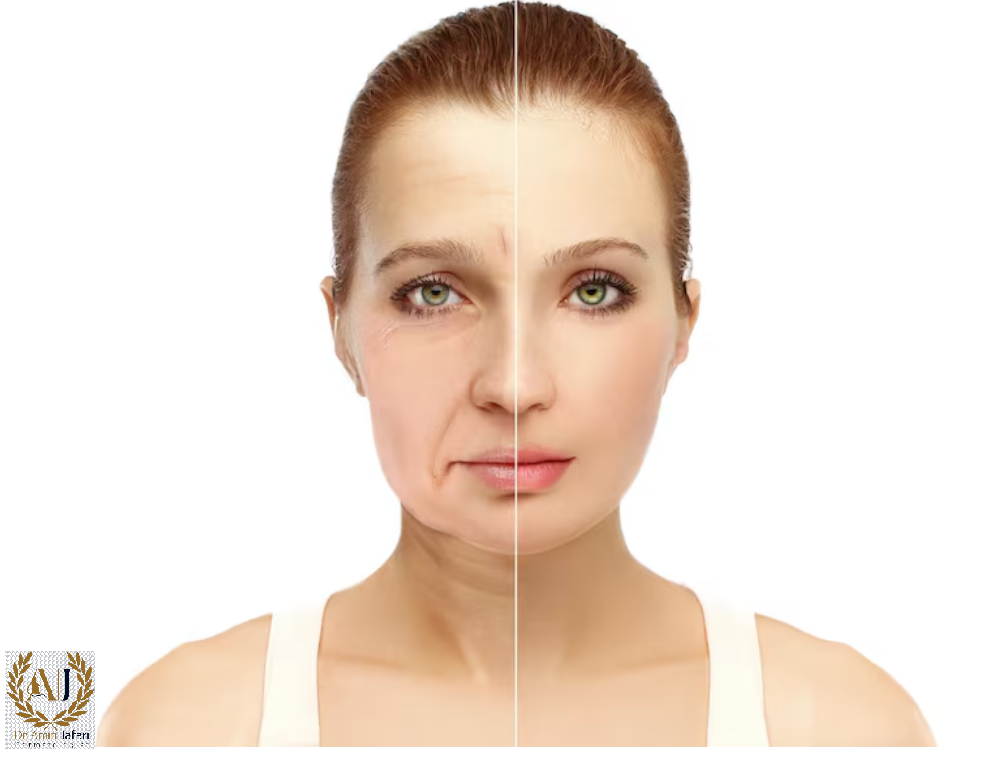 اندولیفت دکتر امین جعفری