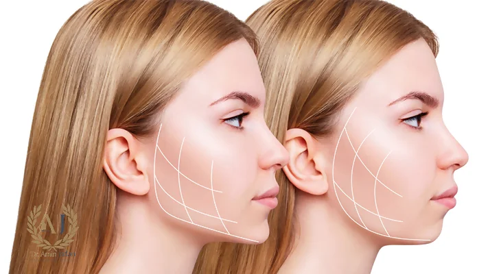 عوارض اندولیفت