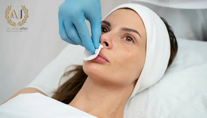 آیا ژل لب تخلیه می شود؟