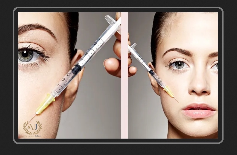 تزریق ژل یا بوتاکس و ضرورت تخلیه ژل