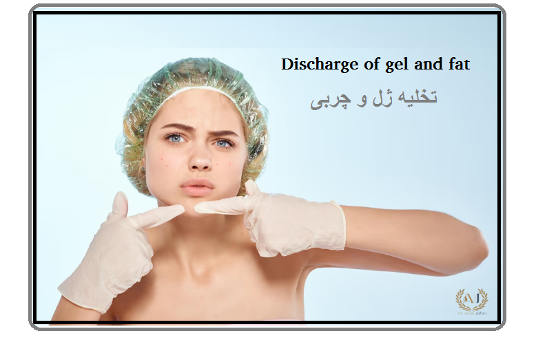 تخلیه ژل و چربی.