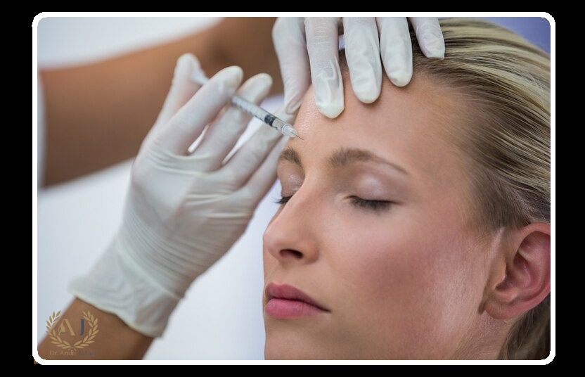 بوتاکس چیست بعد از تخلیه ژل و اندولیفت