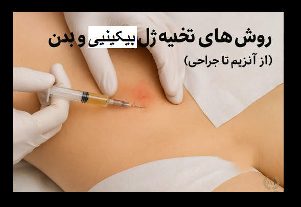 تخلیه ژل بیکینی ضرورت تخلیه