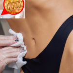 تخلیه فیلر و چربی نامرغوب